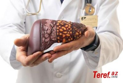 Yağlı qaraciyərin tualetdə görünən əlamətləri