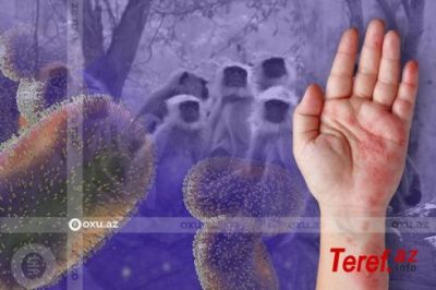 Fransada meymunçiçəyinə minlərlə yoluxma aşkarlanıb
