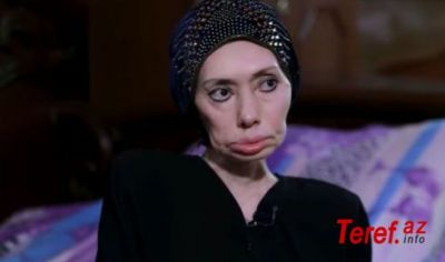 Ayna Sultanovanın nəticəsi: