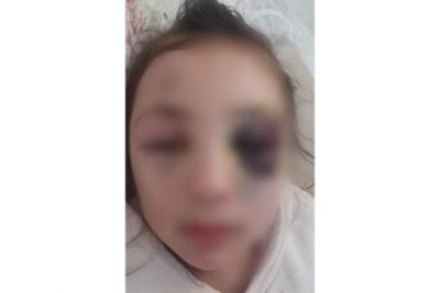 Bakıda şagirdin xəsarət almasına görə müəllimə töhmət verilib