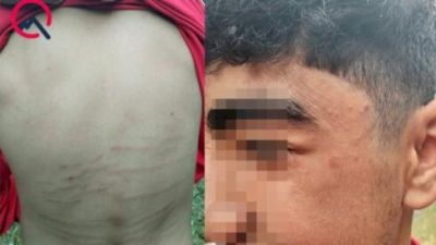 Gəncədə insident: “Qəbələ”nin futbolçuları oyundan sonra döyüldülər