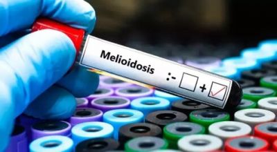 Avstraliyada melioidoz epidemiyası: